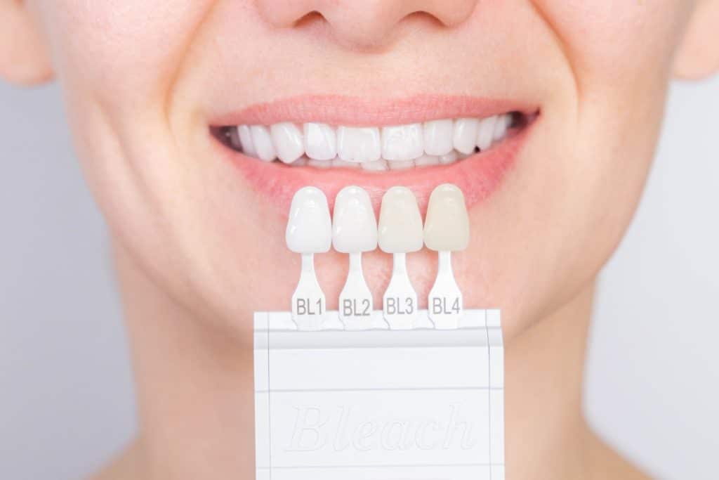 Perfect White Smile With Shade Guide Bleach Color Tooth Dental